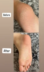 اسپری و جوراب ترک پا🦶🏻 - Image 8